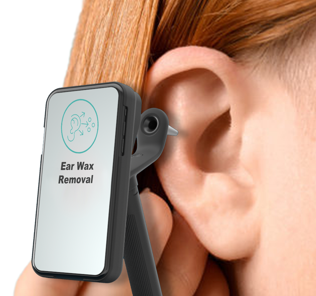 Earwax removal service